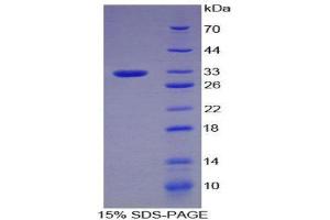 SDS-PAGE (SDS) image for Plasminogen (PLG) (AA 100-352) protein (His tag) (ABIN1880020)