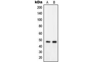 Western blot analysis of GPRIN2 expression in MDAMB435 (A), K562 (B) whole cell lysates. (GPRIN2 antibody  (N-Term))