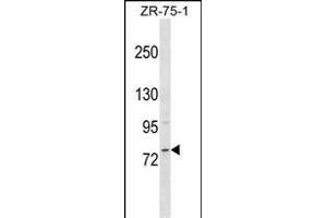 MICALCL Antibody (N-term) (ABIN1539041 and ABIN2849535) western blot analysis in ZR-75-1 cell line lysates (35 μg/lane). (MICALCL antibody  (N-Term))