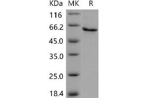 Western Blotting (WB) image for serpin Peptidase Inhibitor, Clade B (Ovalbumin), Member 12 (SERPINB12) protein (His tag) (ABIN7320232) (SERPINB12 Protein (His tag))