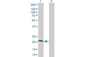 Western Blot analysis of C7orf16 expression in transfected 293T cell line by C7orf16 MaxPab polyclonal antibody. (G Substrate antibody  (AA 1-155))