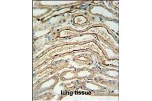 Immunohistochemistry (Paraffin-embedded Sections) (IHC (p)) image for anti-Alcohol Dehydrogenase 7 (Class IV), mu Or sigma Polypeptide (ADH7) (AA 318-346), (C-Term) antibody (ABIN653658)