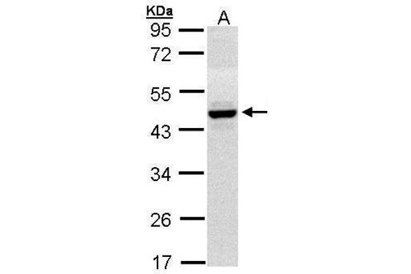 HPD antibody
