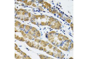 Immunohistochemistry of paraffin-embedded human stomach using HAPLN1 antibody (ABIN5973979) at dilution of 1/100 (40x lens).