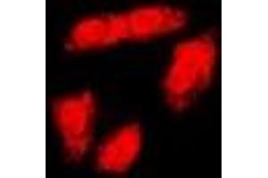 Immunofluorescent analysis of BRCA1 (pS1423) staining in HeLa cells. (BRCA1 antibody  (C-Term, pSer1423))
