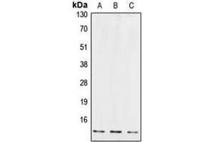 Western blot analysis of Cystatin B expression in JAR (A), EOC20 (B), U87MG (C) whole cell lysates. (CSTB antibody  (Center))
