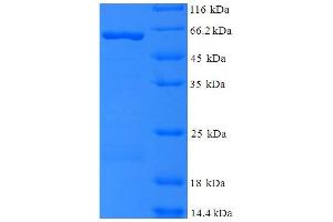 Gag (AA 216-478) protein (GST tag)