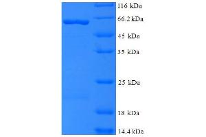 SDS-PAGE (SDS) image for Gag (AA 216-478) protein (GST tag) (ABIN5710990) (Gag (AA 216-478) protein (GST tag))