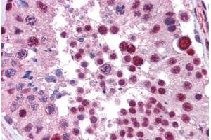 Immunohistochemistry (Paraffin-embedded Sections) (IHC (p)) image for anti-NFKB Repressing Factor (NKRF) (C-Term) antibody (ABIN6741576)