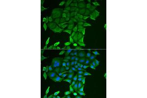 Immunofluorescence analysis of HeLa cells using CD84 antibody (ABIN6132251, ABIN6138235, ABIN6138236 and ABIN6222077). (CD84 antibody  (AA 22-225))