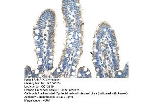 Rabbit Anti-APCS Antibody  Paraffin Embedded Tissue: Human Intestine Cellular Data: Epithelial cells of intestinal villas Antibody Concentration: 4. (APCS antibody  (N-Term))