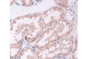 Figure. (IL17D antibody  (AA 35-169))