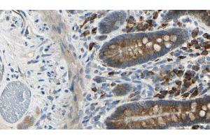 ABIN6274155 at 1/100 staining Mouse intestine tissue by IHC-P. (ADRA2A antibody  (Internal Region))