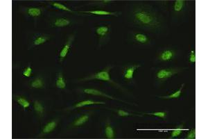 Immunofluorescence of purified MaxPab antibody to AGGF1 on HeLa cell. (AGGF1 antibody  (AA 1-714))