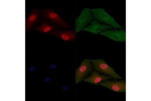 ABIN6257633 and ABIN6274769 staining  cells by IF/ICC.