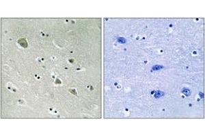 Immunohistochemistry analysis of paraffin-embedded human brain, using PAK1 (Phospho-Ser204) Antibody. (PAK1 antibody  (pSer204))