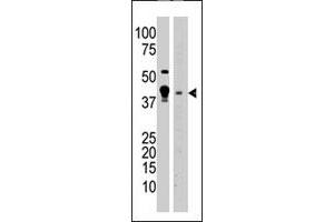 The MBD2 polyclonal antibody  is used in Western blot to detect MBD2 in A-375 cell lysate (lane 1) and mouse brain tissue lysate (lane 2) lysate. (MBD2 antibody  (N-Term))
