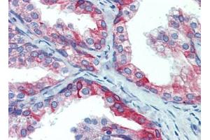 Prostate, Human: Formalin-Fixed, Paraffin-Embedded (FFPE) (PDIA4 antibody  (AA 623-638))