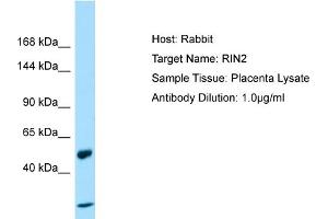 Host: Rabbit Target Name: RIN2 Sample Type: Placenta lysates Antibody Dilution: 1.