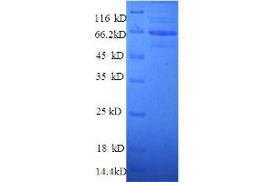 SDS-PAGE (SDS) image for Talin 1 (TLN1) (AA 92-399), (partial) protein (GST tag) (ABIN5712393)