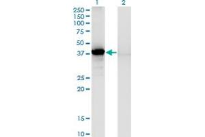 Western Blot analysis of SORD expression in transfected 293T cell line by SORD monoclonal antibody (M03), clone 1C2. (SORD antibody  (AA 1-357))