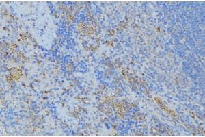 ABIN6277012 at 1/100 staining Human lymph node tissue by IHC-P. (CDA antibody  (Internal Region))