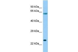 Host: Rabbit Target Name: SPCS3 Sample Type: THP-1 Whole Cell lysates Antibody Dilution: 1. (SPCS3 antibody  (Middle Region))