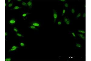 Immunofluorescence of purified MaxPab antibody to SIRT7 on HeLa cell. (SIRT7 antibody  (AA 1-400))