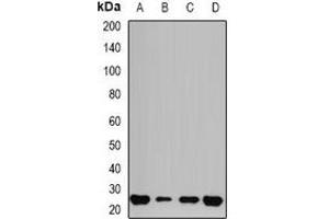 Western blot analysis of GSTP1 expression in HEK293T (A), HepG2 (B), mouse liver (C), mouse lung (D) whole cell lysates. (GSTP1 antibody)