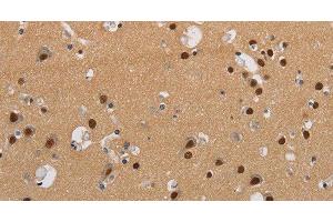 Immunohistochemistry of paraffin-embedded Human brain using KCNG4 Polyclonal Antibody at dilution of 1:40 (KCNG4 antibody)
