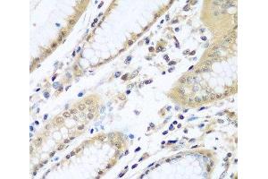Immunohistochemistry of paraffin-embedded Human stomach using WDR48 Polyclonal Antibody at dilution of 1:100 (40x lens). (WDR48 antibody)