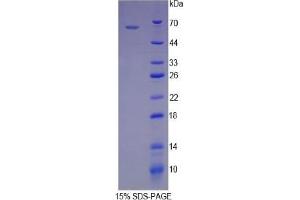 SDS-PAGE (SDS) image for Heat Shock 60kDa Protein 1 (Chaperonin) (HSPD1) ELISA Kit (ABIN6574222)