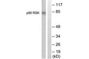 Western blot analysis of extracts from 293 cells, treated with PMA 125ng/ml 30', using p90 RSK (Ab-359/363) Antibody. (RPS6KA3 antibody  (AA 331-380))