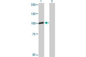 Western Blot analysis of CTNNB1 expression in transfected 293T cell line by CTNNB1 monoclonal antibody (M02), clone 1C9. (CTNNB1 antibody  (AA 682-781))