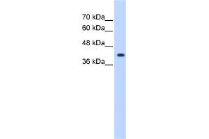 WB Suggested Anti-ST6GALNAC5 Antibody Titration:  1. (ST6GALNAC5 antibody  (Middle Region))