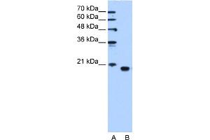 WB Suggested Anti-PEBP1 Antibody Titration:  1. (PEBP1 antibody  (C-Term))