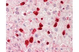 Human Liver: Formalin-Fixed, Paraffin-Embedded (FFPE). (TOM1L1 antibody  (AA 276-325))