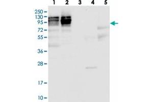 Western blot analysis of Lane 1: RT-4, Lane 2: U-251 MG, Lane 3: Human Plasma, Lane 4: Liver, Lane 5: Tonsil with NOP2 polyclonal antibody  at 1:100-1:250 dilution. (Nucleolar Protein 1 (NOL1) antibody)