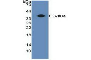 Detection of Recombinant MHCB, Human using Polyclonal Antibody to Major Histocompatibility Complex Class I B (MHCB) (HLA-B antibody  (AA 26-309))