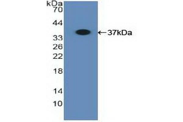 HLA-B anticorps  (AA 26-309)