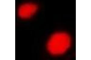 Immunofluorescent analysis of LHX6 staining in A549 cells. (LHX6 antibody)