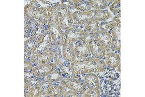 Immunohistochemistry of paraffin-embedded rat kidney using DNAJA3 Antibody. (DNAJA3 antibody  (AA 221-480))