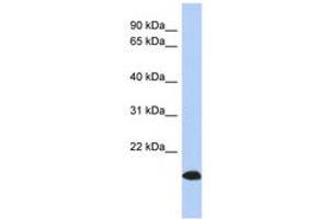 Image no. 1 for anti-ADP-Ribosylation Factor-Like 17A (ARL17A) (AA 107-156) antibody (ABIN6744026) (ARL17A antibody  (AA 107-156))
