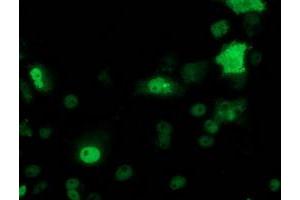 Immunofluorescence (IF) image for anti-Tumor Protein P53 (TP53) antibody (ABIN1499977) (p53 antibody)