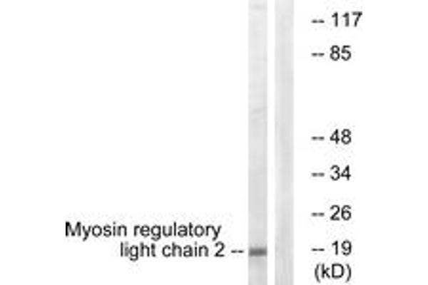 MYL12B antibody  (AA 3-52)