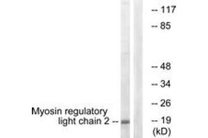 Western blot analysis of extracts from COLO205 cells, using MRLC2 (Ab-18) Antibody.