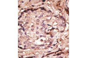 Image no. 2 for anti-Glial Fibrillary Acidic Protein (GFAP) (N-Term) antibody (ABIN357395) (GFAP antibody  (N-Term))