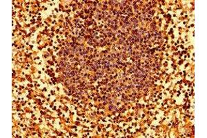 Immunohistochemistry of paraffin-embedded human lymph node tissue using ABIN7155571 at dilution of 1:100 (HLA-C antibody  (AA 62-306))