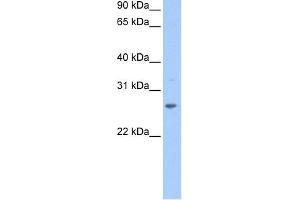 WB Suggested Anti-CRISP1 Antibody Titration: 0. (CRISP1 antibody  (N-Term))