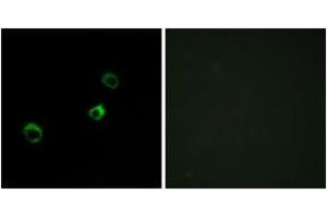 Image no. 2 for anti-Cytochrome B-561 Domain Containing 1 (CYB561D1) (AA 180-229) antibody (ABIN2889869) (CYB561D1 antibody  (AA 180-229))